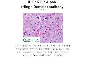 Image no. 1 for anti-RAR-Related Orphan Receptor A (RORA) antibody (ABIN1738922)