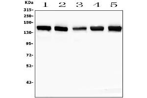Western blot analysis of SMARCAD1 using anti-SMARCAD1 antibody (ABIN6719539).