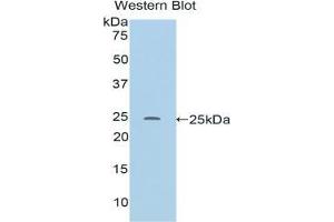 Western blot analysis of the recombinant protein. (RALBP1 抗体  (AA 192-380))