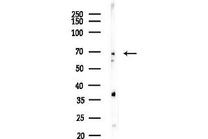 Western blot analysis of lysates from F10-LUC cells(heat-shock, 45 min treatment), using AHCYL1 Antibody at 1/1000 dilution.
