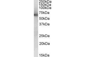 Western Blotting (WB) image for anti-Aldehyde Dehydrogenase 1 Family, Member B1 (ALDH1B1) (AA 363-375) antibody (ABIN490734) (ALDH1B1 抗体  (AA 363-375))