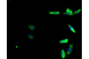 Immunofluorescence (IF) image for anti-Ribosomal Protein L19 (RPL19) (AA 79-196) antibody (ABIN7142764)