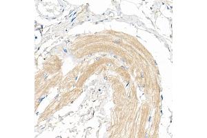 Immunohistochemistry of paraffin-embedded Human skeletal muscle using COX7 Rabbit pAb (4721) at dilution of 1:50 (40x lens). (COX7A1 抗体  (AA 1-79))