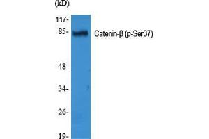 Western Blot (WB) analysis of specific cells using Phospho-Catenin-beta (S37) Polyclonal Antibody. (beta Catenin 抗体  (pSer37))