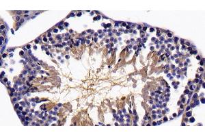 Detection of SIRT5 in Mouse Testis Tissue using Polyclonal Antibody to Sirtuin 5 (SIRT5) (SIRT5 抗体  (AA 37-310))