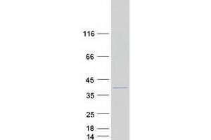 TNNT3 Protein (Transcript Variant 4) (Myc-DYKDDDDK Tag)