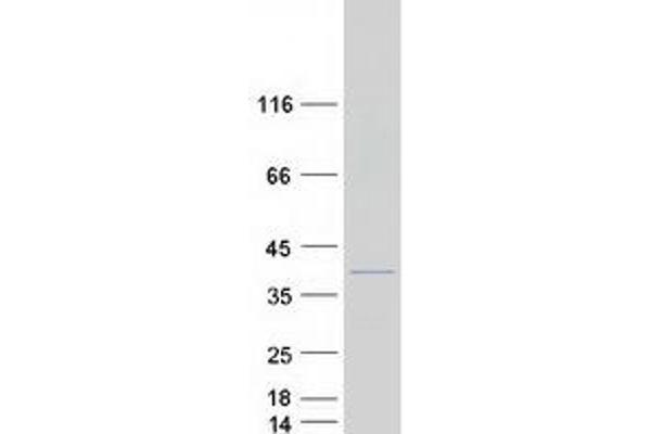 TNNT3 Protein (Transcript Variant 4) (Myc-DYKDDDDK Tag)