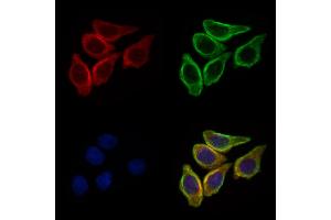 ABIN6257165 and ABIN6275114 staining HepG2 cells by IF/ICC. (EPN3 抗体  (Internal Region))
