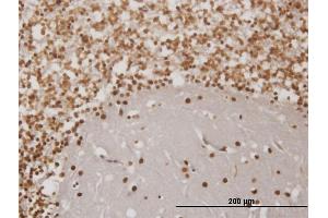 Immunoperoxidase of monoclonal antibody to EN1 on formalin-fixed paraffin-embedded human cerebellum. (EN1 抗体  (AA 266-392))
