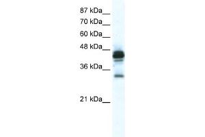 WB Suggested Anti-GJE1 Antibody Titration:  2. (GJE1 抗体  (C-Term))