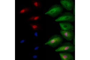 ABIN6257713 and ABIN6273763 staining  cells by IF/ICC. (ING2 抗体  (C-Term))