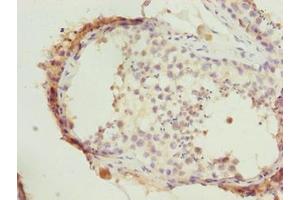 Immunohistochemistry of paraffin-embedded human testis tissue using ABIN7164431 at dilution of 1:100 (HERC6 抗体  (AA 764-1022))