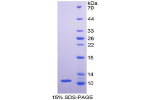 SDS-PAGE (SDS) image for Pyruvate Kinase M2 (PKM2) (AA 141-248) protein (His tag) (ABIN2121973)