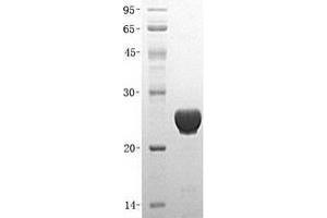 Validation with Western Blot (Ube2t Protein (His tag))