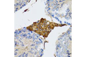 Immunohistochemistry of paraffin-embedded rat testis using PGRMC1 antibody (ABIN1876820) at dilution of 1:100 (40x lens). (PGRMC1 抗体)