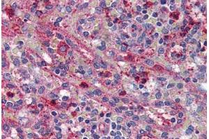 Immunohistochemistry (IHC) image for anti-Activin Receptor Type 1C (ACVR1C) (Internal Region) antibody (ABIN1048286)
