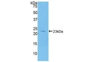 Detection of Recombinant HSPb2, Human using Polyclonal Antibody to Heat Shock Protein Beta 2 (HSPb2) (HSPB2 抗体  (AA 12-182))