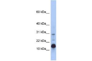 WB Suggested Anti-HIST2H2BF Antibody Titration: 0. (HIST2H2BF 抗体  (N-Term))