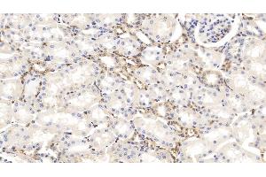 Detection of GSN in Bovine Kidney Tissue using Monoclonal Antibody to Gelsolin (GSN) (Gelsolin 抗体  (AA 170-423))