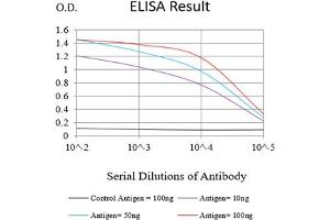 Black line: Control Antigen (100 ng),Purple line: Antigen (10 ng), Blue line: Antigen (50 ng), Red line:Antigen (100 ng) (MYLK 抗体  (AA 1375-1524))