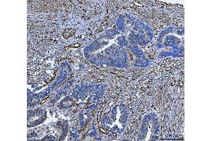 IHC analysis of TP53I13 using anti-TP53I13 antibody (ABIN7601220). (TP53I13 抗体  (AA 30-365))