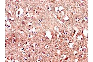 Immunohistochemistry of paraffin-embedded human brain tissue using ABIN7158114 at dilution of 1:100 (LRRTM4 抗体  (AA 259-419))