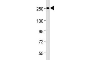 Western blot testing of Nestin antibody at 1:2000 dilution + HeLa lysate (Nestin 抗体  (AA 1389-1416))