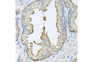 Immunohistochemistry of paraffin-embedded human prostate using ATG5 antibody. (ATG5 抗体)