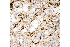 Anti-liver FABP antibody,  IHC(P) IHC(P): Human Liver Cancer Tissue (FABP1 抗体  (N-Term))