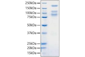 Recombinant 2019-nCoV S1+S2 ECD (S-ECD) Protein was determined by SDS-PAGE with Coomassie Blue, showing bands around 80, 110, 180 kDa. (SARS-CoV-2 Spike Protein (ECD) (His tag))
