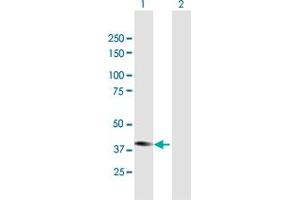 Western Blot analysis of STYK1 expression in transfected 293T cell line by STYK1 MaxPab polyclonal antibody. (STYK1 抗体  (AA 1-422))