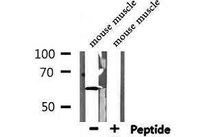 Western Blotting (WB) image for anti-Potassium Voltage-Gated Channel, KQT-Like Subfamily, Member 1 (KCNQ1) (C-Term) antibody (ABIN6262757)
