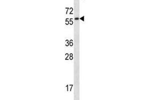 Fyn antibody western blot analysis in mouse lung tissue lysate.