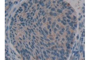 Immunohistochemistry (IHC) image for anti-Chemokine (C-X-C Motif) Ligand 12 (CXCL12) (AA 23-89) antibody (ABIN7431116)