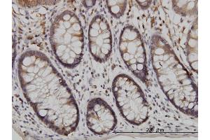Immunoperoxidase of monoclonal antibody to USP48 on formalin-fixed paraffin-embedded human colon. (USP48 抗体  (AA 110-219))