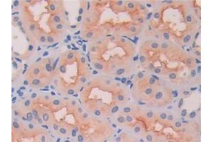 Detection of HEXb in Human Kidney Tissue using Polyclonal Antibody to Hexosaminidase B Beta (HEXb) (HEXB 抗体  (AA 122-311))