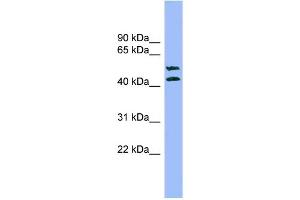 WB Suggested Anti-TMPRSS3 Antibody Titration: 0. (TMPRSS3 抗体  (N-Term))