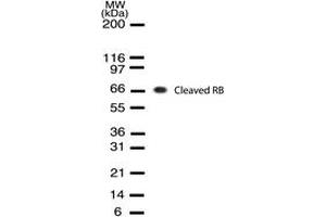 Image no. 1 for anti-Retinoblastoma Protein (Rb Protein) (Cleavage Site) antibody (ABIN207915) (Retinoblastoma Protein (Rb) 抗体  (Cleavage Site))