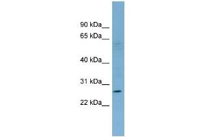 WB Suggested Anti-KLRF1 Antibody Titration:  0. (KLRF1 抗体  (Middle Region))