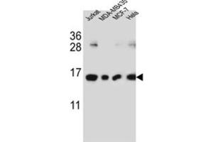 Western Blotting (WB) image for anti-H2A Histone Family, Member J (H2AFJ) antibody (ABIN3002385) (H2AFJ 抗体)
