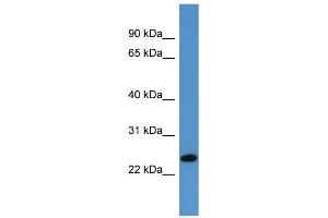 WB Suggested Anti-TP53INP1 Antibody Titration: 0. (TP53INP1 抗体  (C-Term))