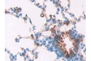 Detection of SPA2 in Rat Lung Tissue using Polyclonal Antibody to Surfactant Associated Protein A2 (SPA2) (SFTPA2 抗体  (AA 21-248))