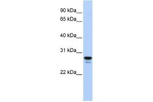 WB Suggested Anti-HMGB2 Antibody Titration: 0. (HMGB2 抗体  (Middle Region))