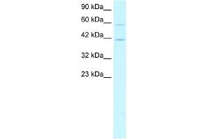 WB Suggested Anti-CREB5 Antibody Titration:  1. (CREB5 抗体  (N-Term))