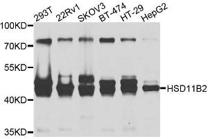 Western blot analysis of extracts of various cells, using HSD11B2 antibody. (HSD11B2 抗体)