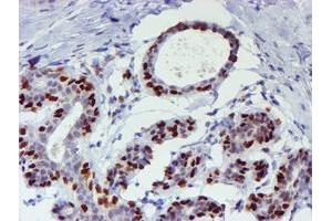 Immunohistochemical staining of paraffin-embedded Human breast tissue using anti-WWTR1 mouse monoclonal antibody.