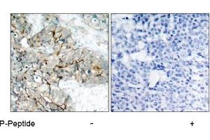 Image no. 1 for anti-Integrin beta 3 (ITGB3) (pTyr773) antibody (ABIN196720) (Integrin beta 3 抗体  (pTyr773))