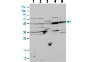 Western blot analysis of Lane 1: RT-4, Lane 2: U-251 MG, Lane 3: Human Plasma, Lane 4: Liver, Lane 5: Tonsil with NARFL polyclonal antibody  at 1:250-1:500 dilution. (NARFL 抗体)