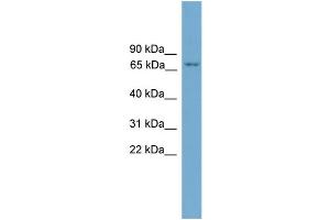 WB Suggested Anti-PRKCH AntibodyTitration: 1. (PKC eta 抗体  (N-Term))
