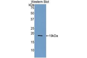 Detection of recombinant NUCB2 using Polyclonal Antibody to Nucleobindin 2 (NUCB2) (NUCB2 抗体  (AA 108-246))